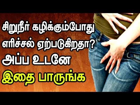 சிறுநீர் கடுகடுப்பு சிறுநீர்த்தாரை எரிச்சல் சிறுநீர் சொட்டுச் சொட்டாக போதல் சரியாக!