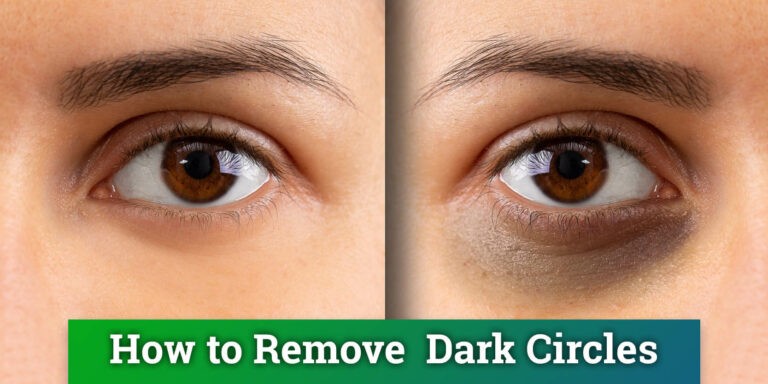 Tips to Remove Dark Circle in Eyes