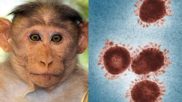 Don't worry anymore!.. Discovery of test kit to diagnose monkey measles!.