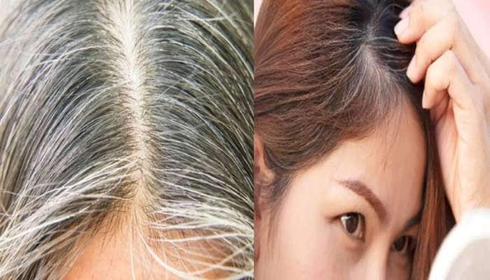 Solution to gray hair problem in one week! This one betel nut is enough!