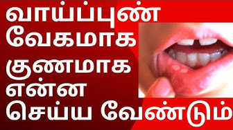 இந்த 5 பொருள் இருந்தா போதும் வாய்ப்புண் வர வாய்ப்பில்லை!! வேகமாக குணமாகும் சூப்பர் டிப்ஸ்!!