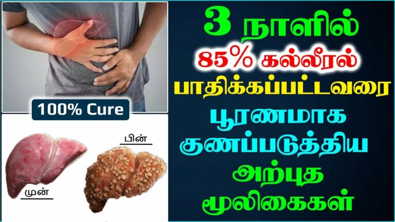 இதனை மட்டும் சாப்பிட்டால் போதும்!! மூன்று நாட்களில் 85% கொழுப்பு கல்லீரலை குணப்படுத்தலாம்!!