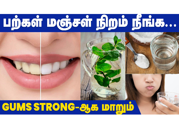 மஞ்சள் கறை படிந்த பற்களுக்கு குட்பை சொல்லிடுங்க!! இனி நன்றாக புன்னகை செய்யுங்கள்!!