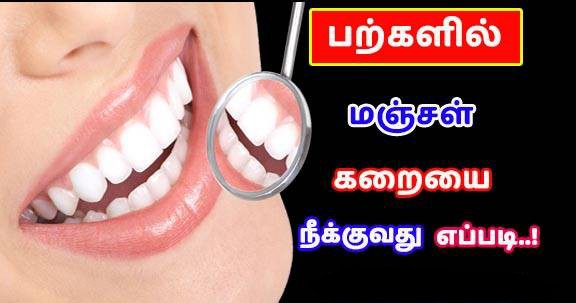 மஞ்சள் பற்கள் வெளுவெளுப்பாக எளிய வழி இதோ!! 100% இயற்கை முறை!!