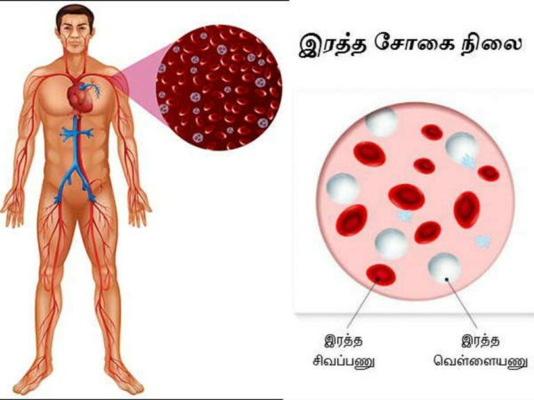 இந்த பொடியை பாலில் கலந்து குடித்தால் இரத்த சோகை நீங்கும் இரத்தம் ஊரும்!!