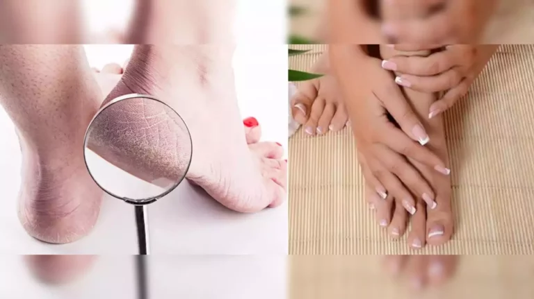 This is the magic cream that will make your feet's blemishes disappear!!