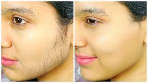 Getting rid of unwanted facial hair is now easy!! There is a complete solution!