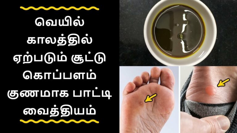 Hot blisters in private area during summer can be cured in 1 week!! Here's an easy remedy!!