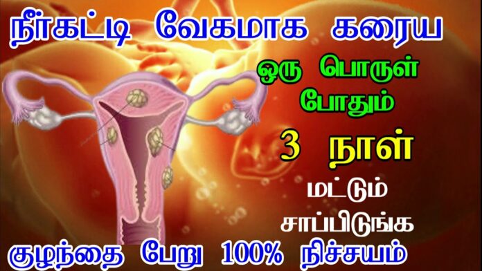 If you drink this once on the period days, the cyst will dissolve and you will get pregnant in the next month!! If you drink this once on the period days, the cyst will dissolve and you will get pregnant in the next month!!