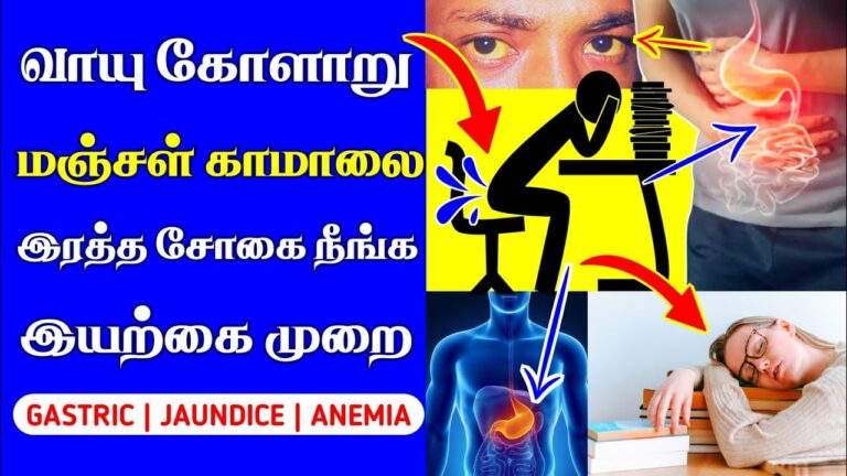 How to Cure Jaundice with Home Remedies