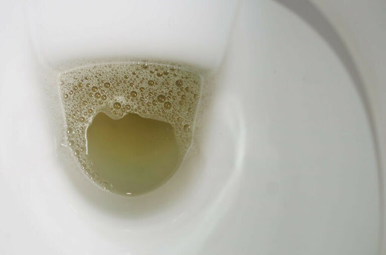 FOAMY URINE: Do you have foamy urine? Here are the reasons and solutions for this!