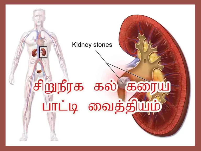 If you have these 3 leaves, any stone in the kidney will be removed!! No more life-promoting pills!!