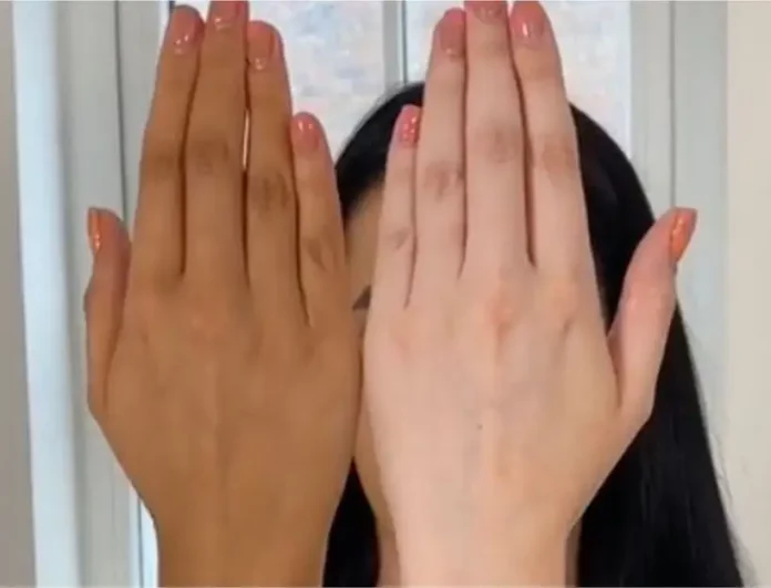 Are your palms black? Then do this immediately and get rid of the blackness!!