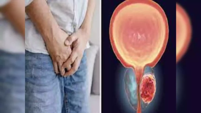 TESTICULAR PAIN: Men, don't ignore painful swelling in your testicles!!