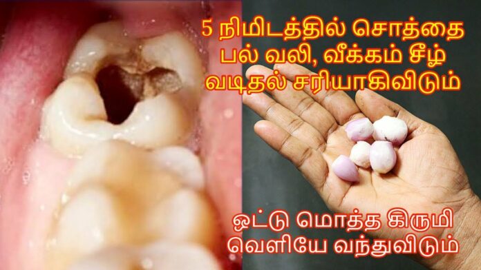 Can't bear toothache pain.. immediately use garlic like this!! Pain free in 5 minutes!!