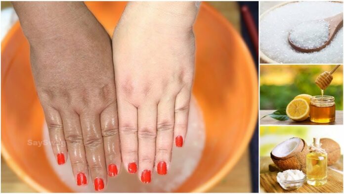 Do you have dark skin on your hands and feet? So use baking soda like this!