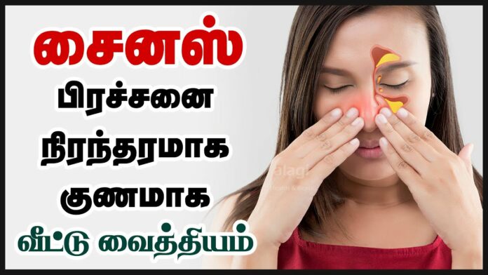 SINUS INFECTION: Herbal Remedy for Immediate Remedy of Sinus Problem!! Just do this!