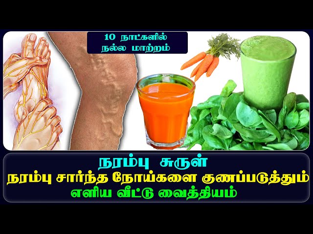 In 7 days you can fix the problem of varicose veins!! Just follow this!!