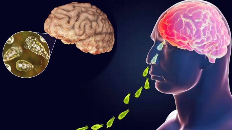 People beware.. Brain eating amoeba!! Important information published by the Department of Health!!