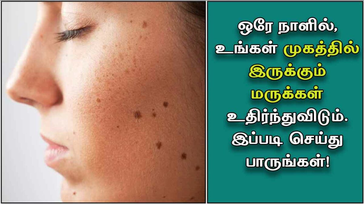 Powerful Home Remedies to Get Rid of Chronic Warts!! Try it immediately!!