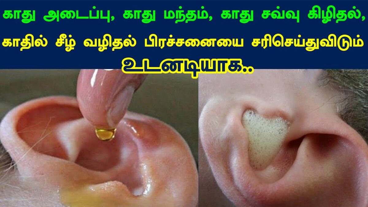 If you use castor leaf + vasamba like this.. ear pus will stop immediately!!