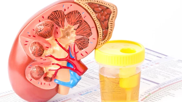 Urine Infection: Urinary tract infection is cured.. Rice porridge is enough!