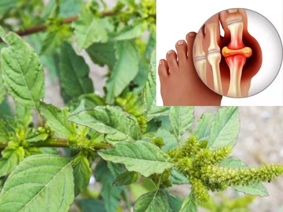 URIC ACID: Want to reduce uric acid naturally? Then try these boots!