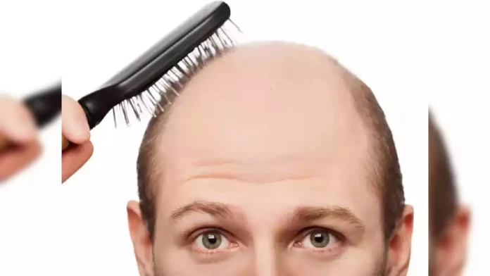 Guys if you do this mistake your head will definitely become bald!! Don't forget all this!!