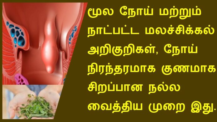 Hemorrhoids can be completely cured without operation!! Eat this for 20 days only 100% permanent solution!!