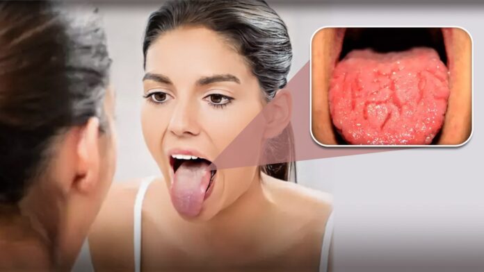 Do you notice this change in your tongue? Warning.. Great danger awaits!!