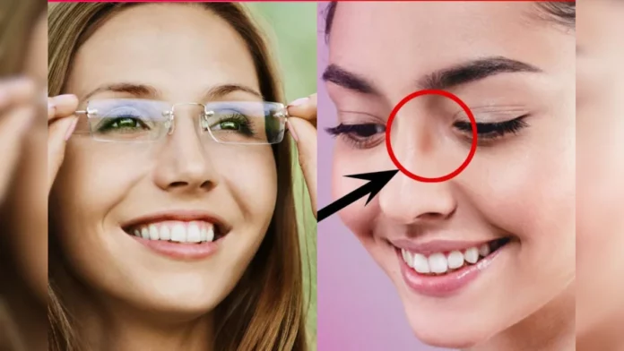 Just do this at home to easily remove eyeglass marks!!