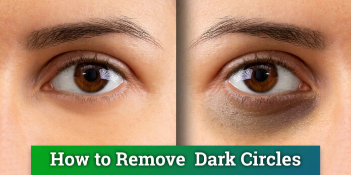 Do this to get rid of dark spots that spoil the beauty of your eyes..