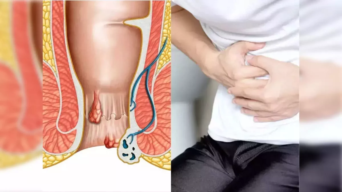 Powerful Home Remedies to Root the Root!! Once you do it, there will be no trouble for life!!