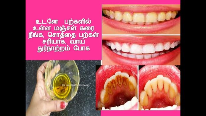 To get rid of yellowness in the teeth,