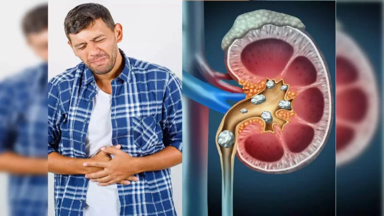 A rare herbal seed that helps to fix kidney stones!! Mix it with milk and drink it!