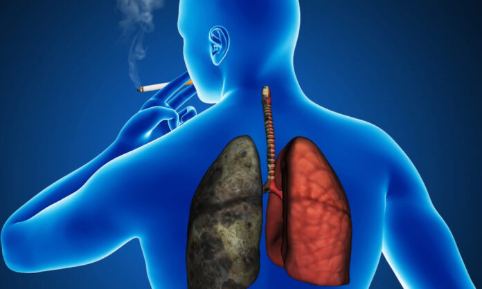 Does smoking cause lung damage? Simple ways to help restore its health!