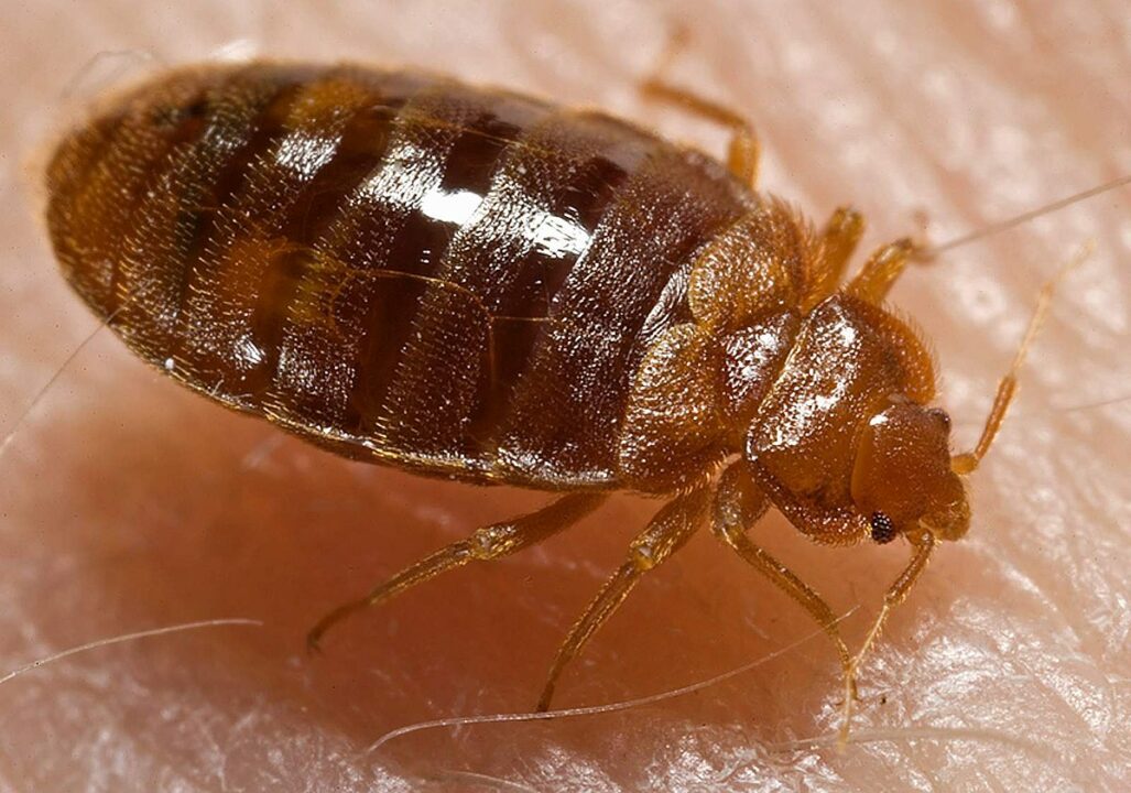 Are bed bugs infested with bed linens? If you do this, everything will be gone in one day!!