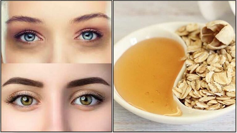 Don't doubt it.. If you try one of these 5 tips to get rid of dark circles in one day!
