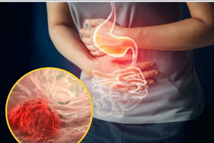 Suffering from digestive problems? Cure in one day.. Put tea in this one thing and drink it!