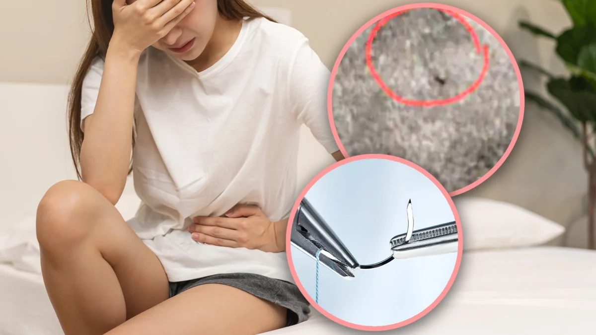 A needle stuck in a woman's genital area due to mistreatment