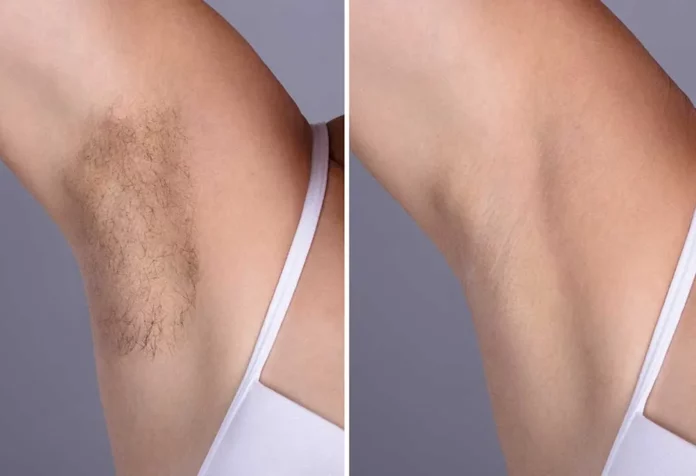 armpit hair removal natural tips