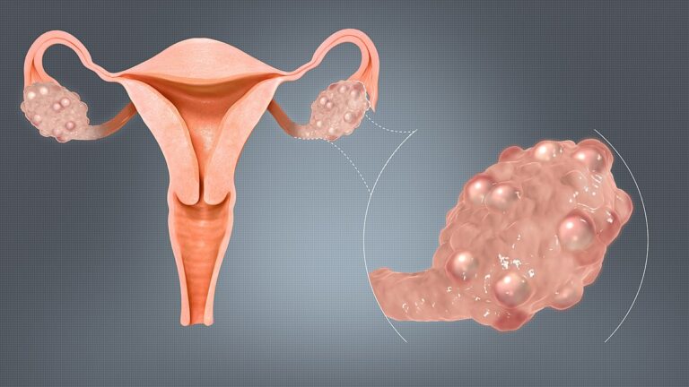 PCOS Problem? Drink this juice for a week.. 100% of testicles will dissolve!!