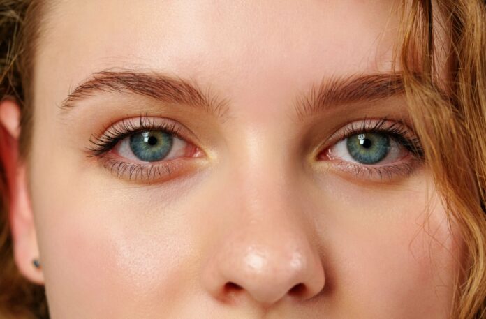 Do you often get watery eyes? Apply this oil around the eyes!!