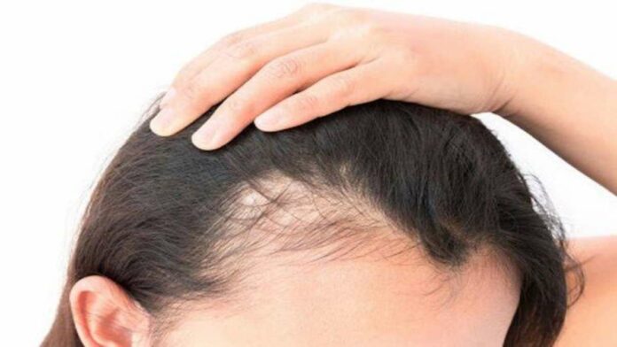 Bald forehead problem? Distill this leaf in coconut oil and reap the benefits!!