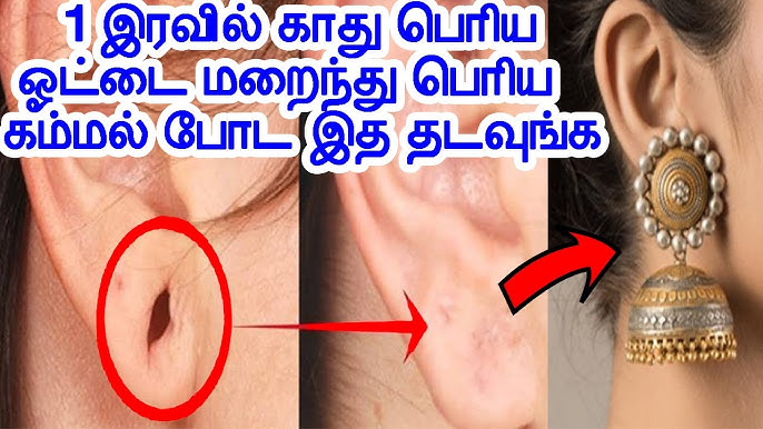 Are the ear canals enlarged? This is one item that can help fix this!!