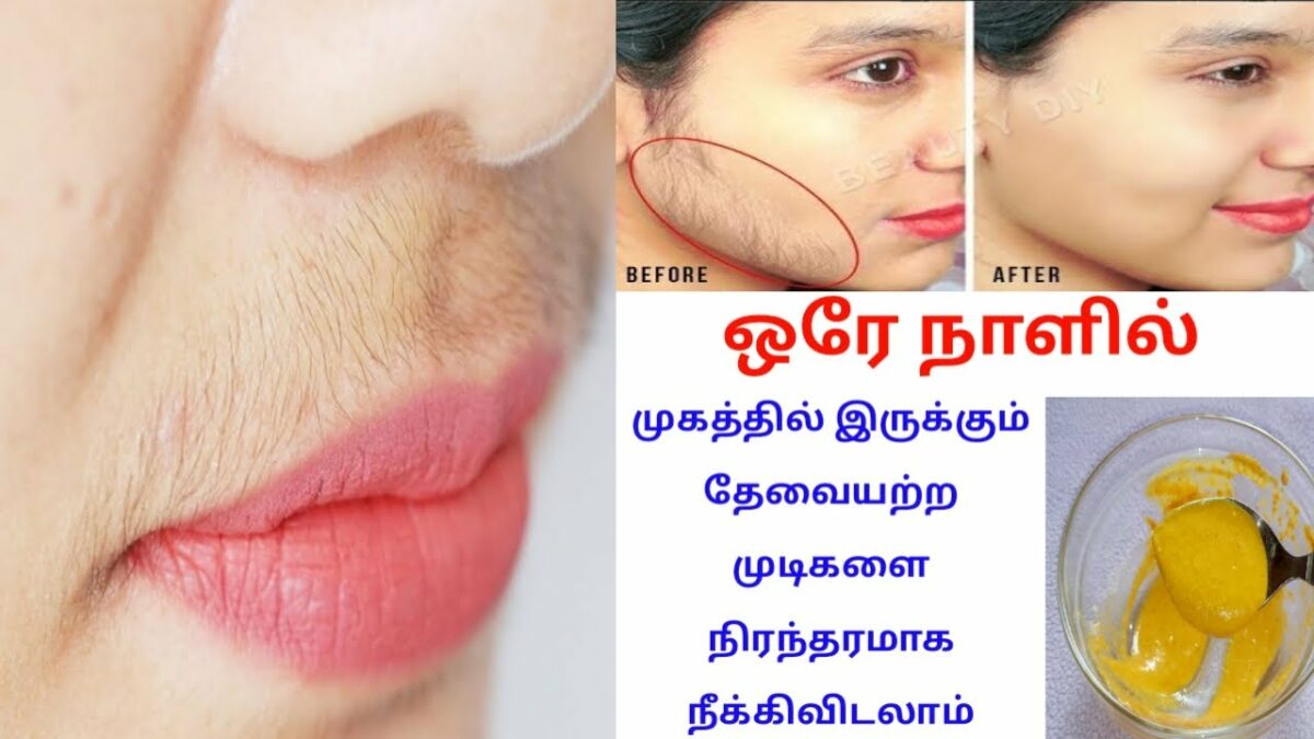 Just do this ladies to get rid of unwanted facial hair permanently!!