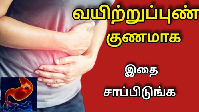 Magic powder for ulcers and stomach ulcers!! Permanent solution in one week!!