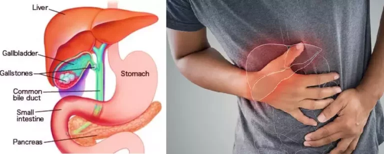 "Bile Suranam" which cures Bile disorder!! How to prepare and use?