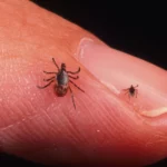 Fast spreading tick fever!! Increased fear in Tamil Nadu!!