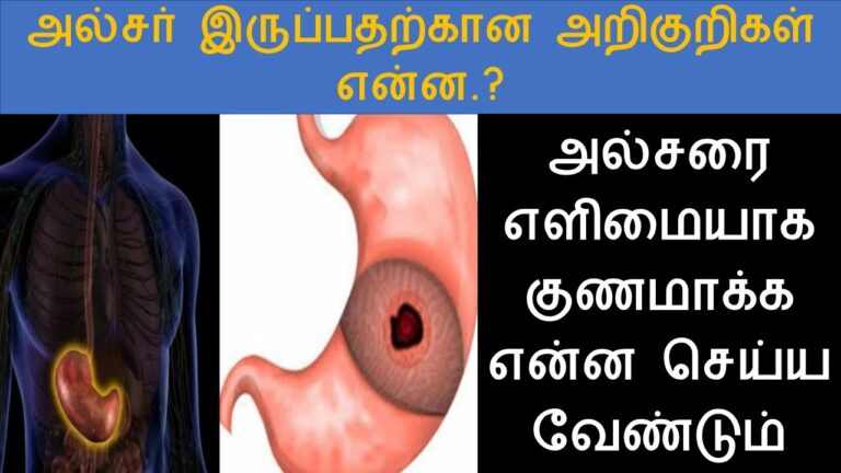 அல்சர் புண்களை ஆற்றும் அரிசி கஞ்சி!! தினம் ஒரு கப் குடிங்க.. 7 நாளில் ரிசல்ட் உறுதி!!